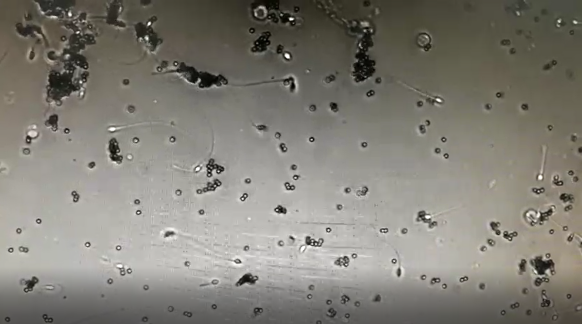 MAR Method IgG Detection Kit for Sensitive Antibody Testing