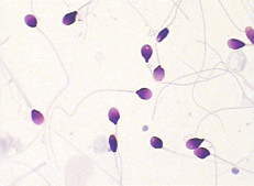 BRED-015 Sperm morphology staining kit (Diff-quik rapid staining method)