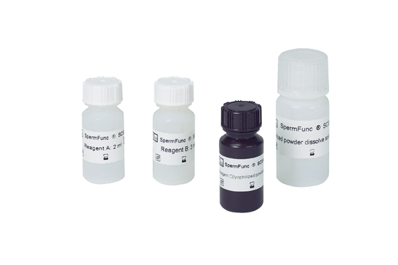 Sperm DNA fragmentation test sperm chromatin structure assay SCSA