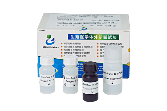 Sperm DNA Fragment Assay Kit (Acridine Orange SCSA Method)