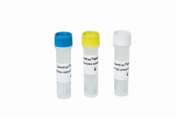Anti-Sperm antibody IgG detection (MAR method)